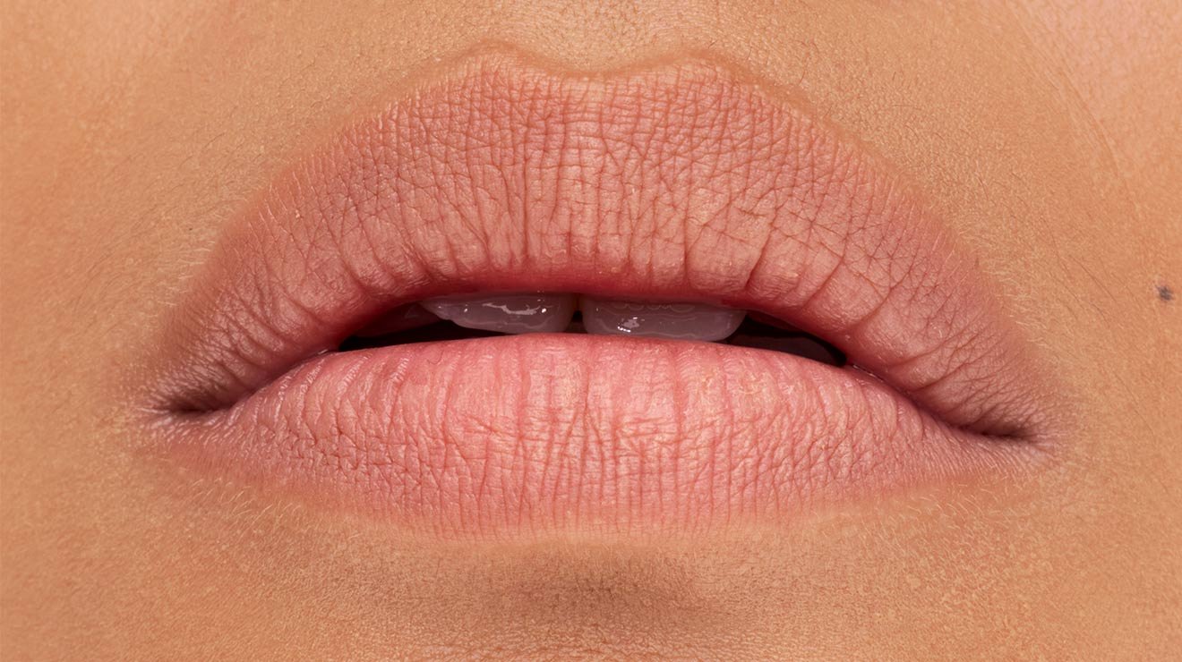 Lifter Gel Lip Πριν