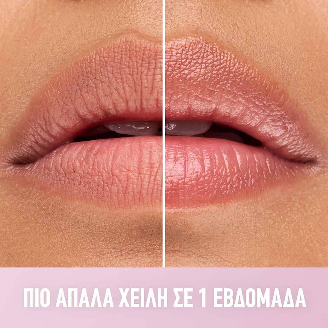 Lip Lifter Gel πιο Απαλά Χείλη σε Μια Βδομάδα