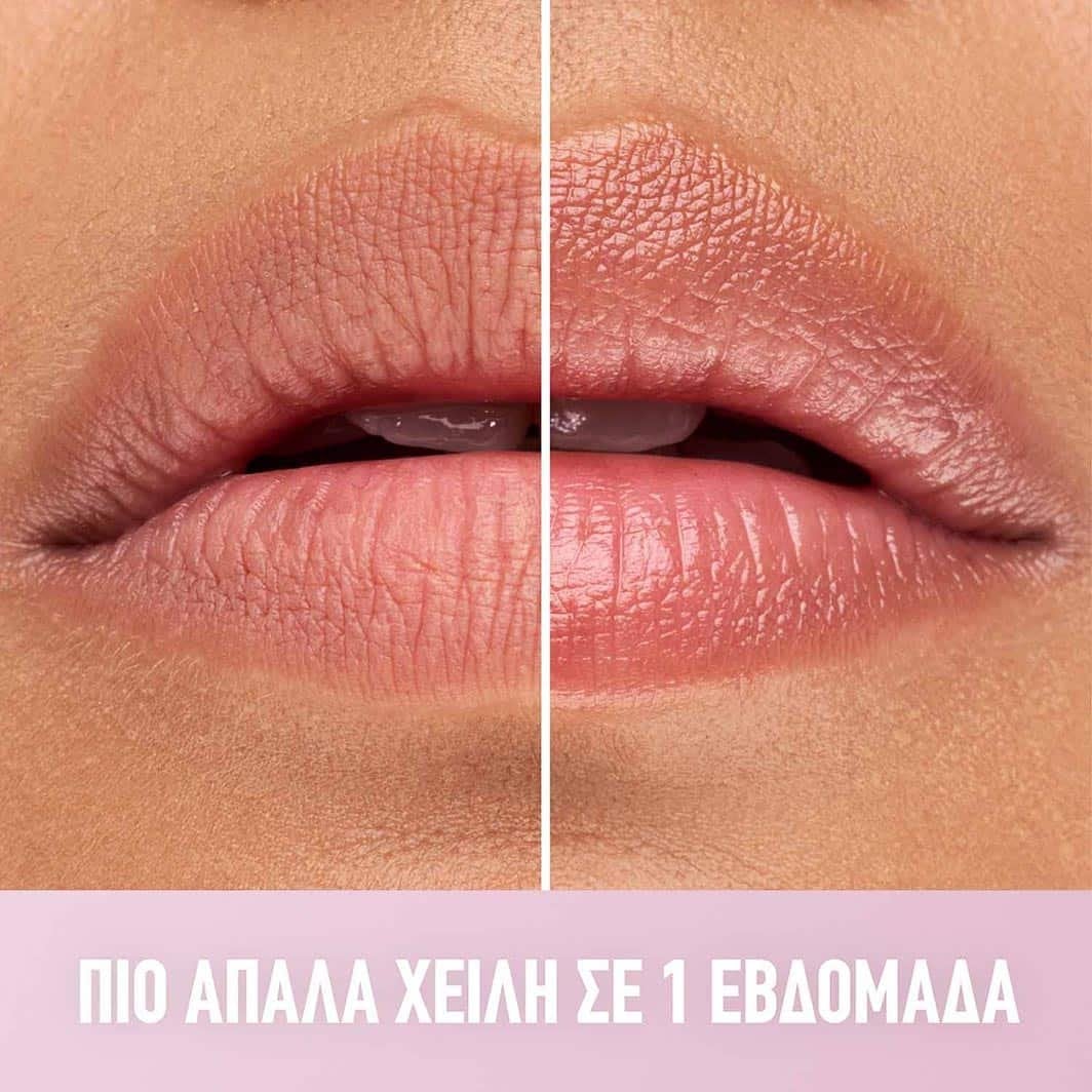 Lip Lifter Gel πιο Απαλά Χείλη σε Μια Βδομάδα